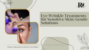 Eye Wrinkle Treatments for Sensitive Skin Gentle Solutions