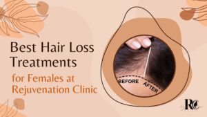 Best Hair Loss Treatment for Female