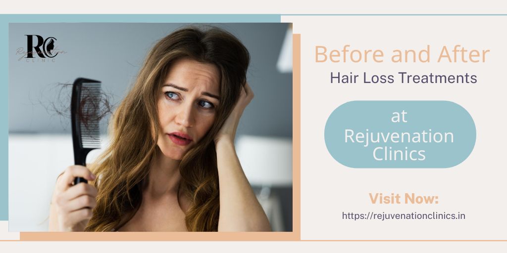 Before and After Hair Loss Treatments at Rejuvenation Clinics