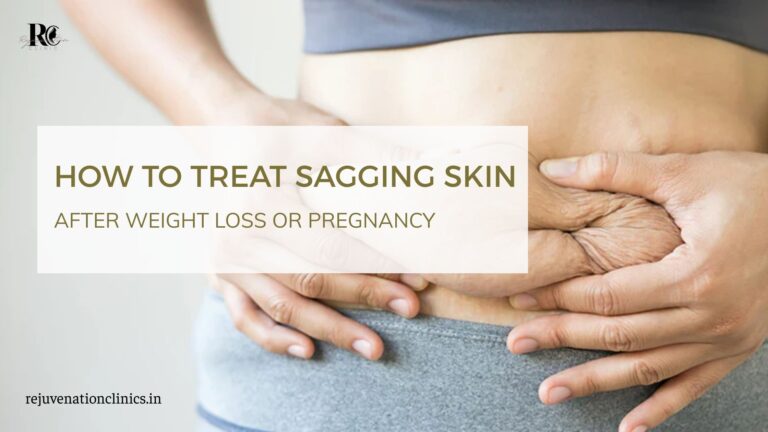 How to Treat Sagging Skin