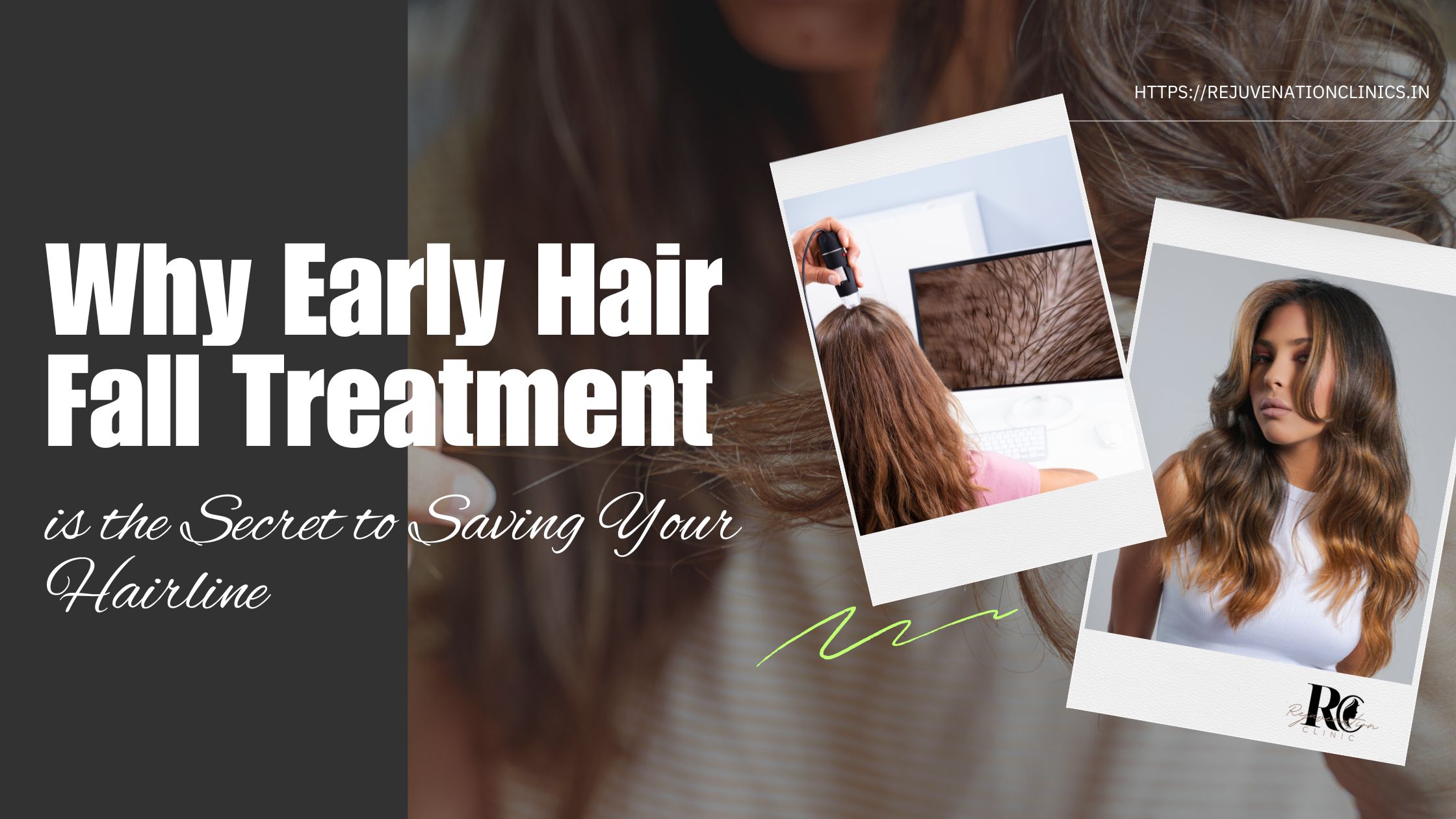 Why Early Hair Fall Treatment is the Secret to Saving Your Hairline